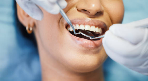 Best Emergency Tooth Extraction in Dalton, OH